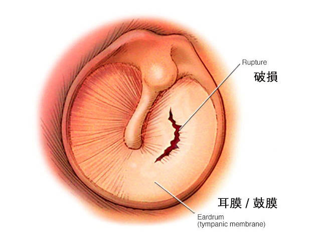 鼓膜详解图图片