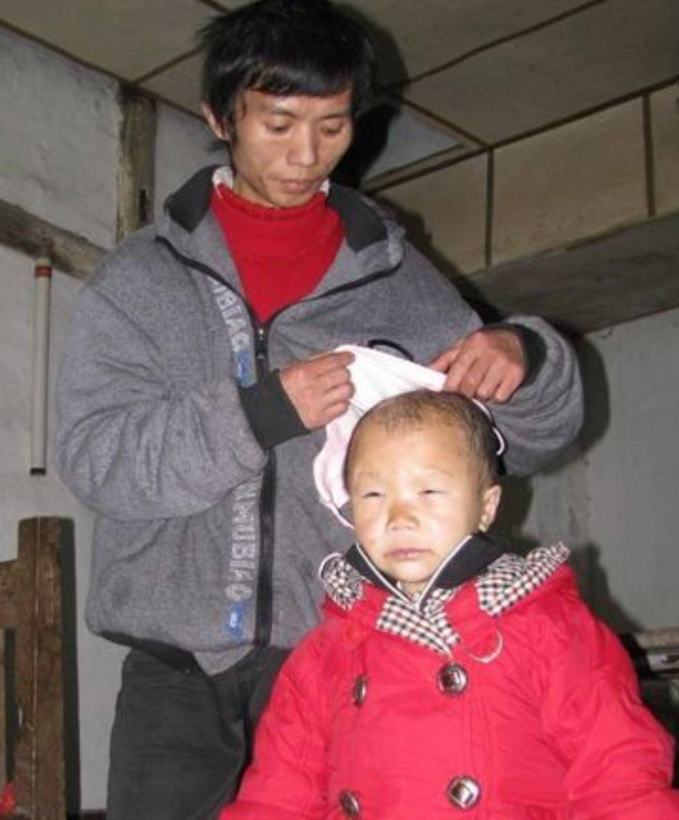 "不老女孩"曾玉珊:7岁衰老,17岁变成孩童模样,怎么回事?