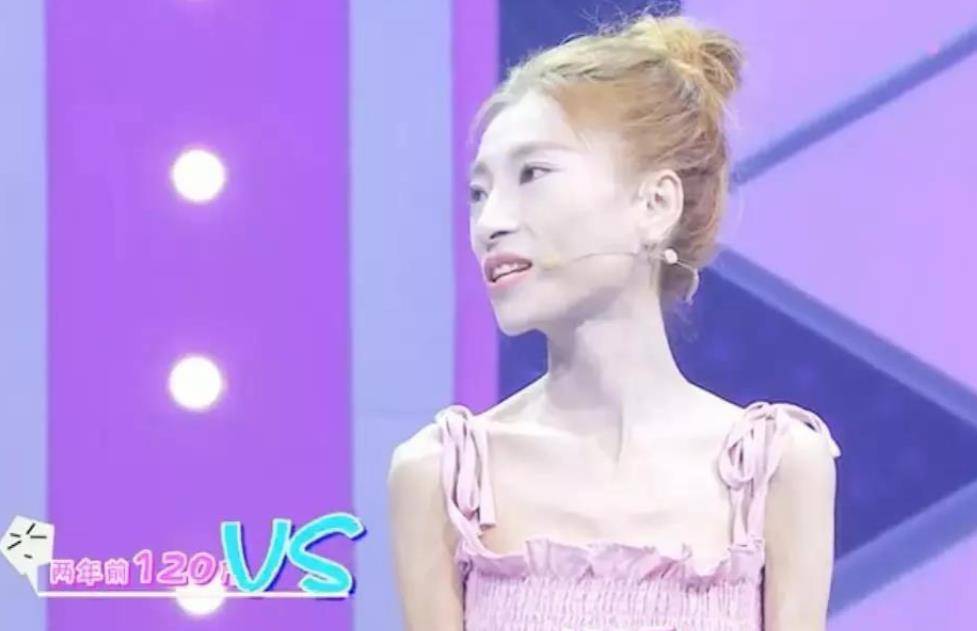 "骷髅妹"刘野:自虐式减肥,120斤减到57斤,直接吓跑网恋对象