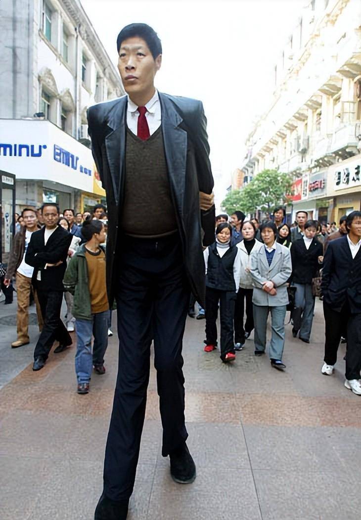 亚洲第一巨人张俊才:身高竟达242米,斩获世界纪录后生活如何?