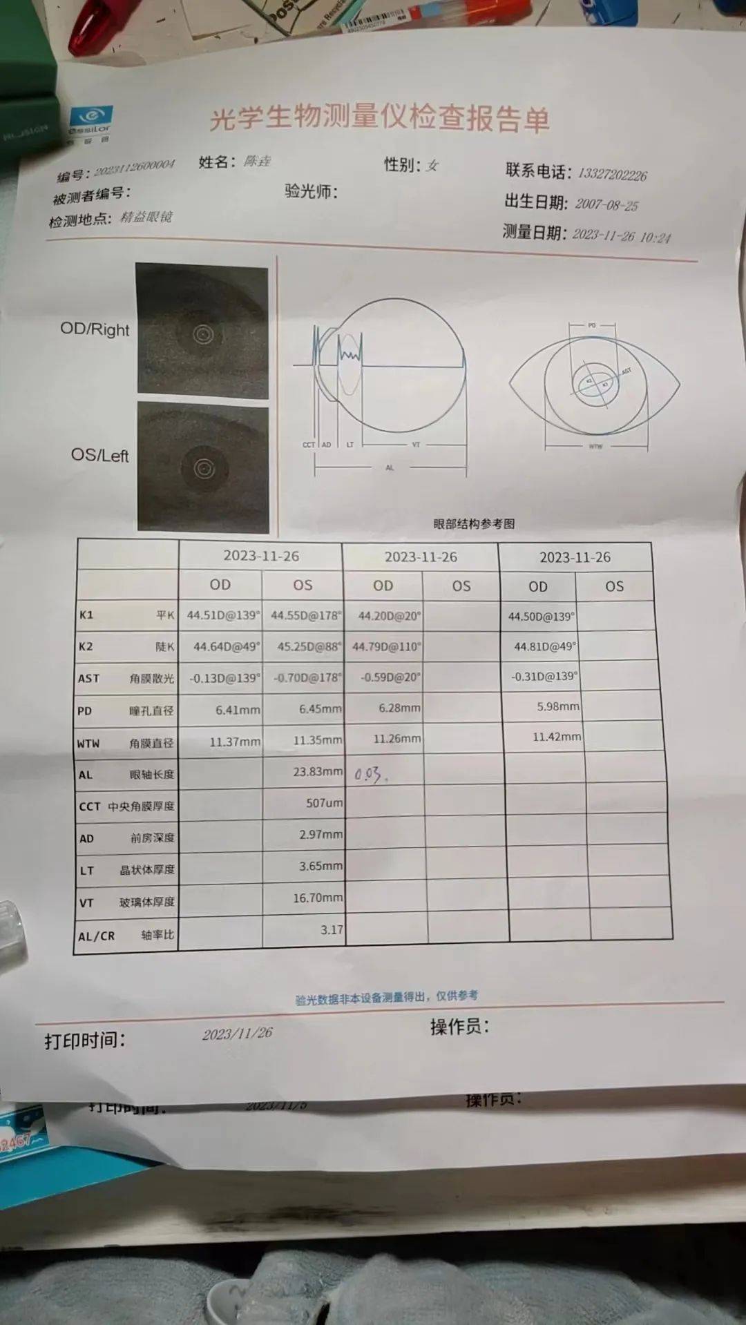 鹰眼检测报告图片