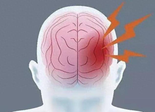 别等大脑遭遇"堵塞"你再去治疗!远离6个不良习惯,预防脑梗塞