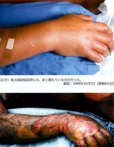 在警报器响起的那一刻,大内久和同事们立马意识到