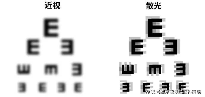 孩子的散光,还能治好吗?