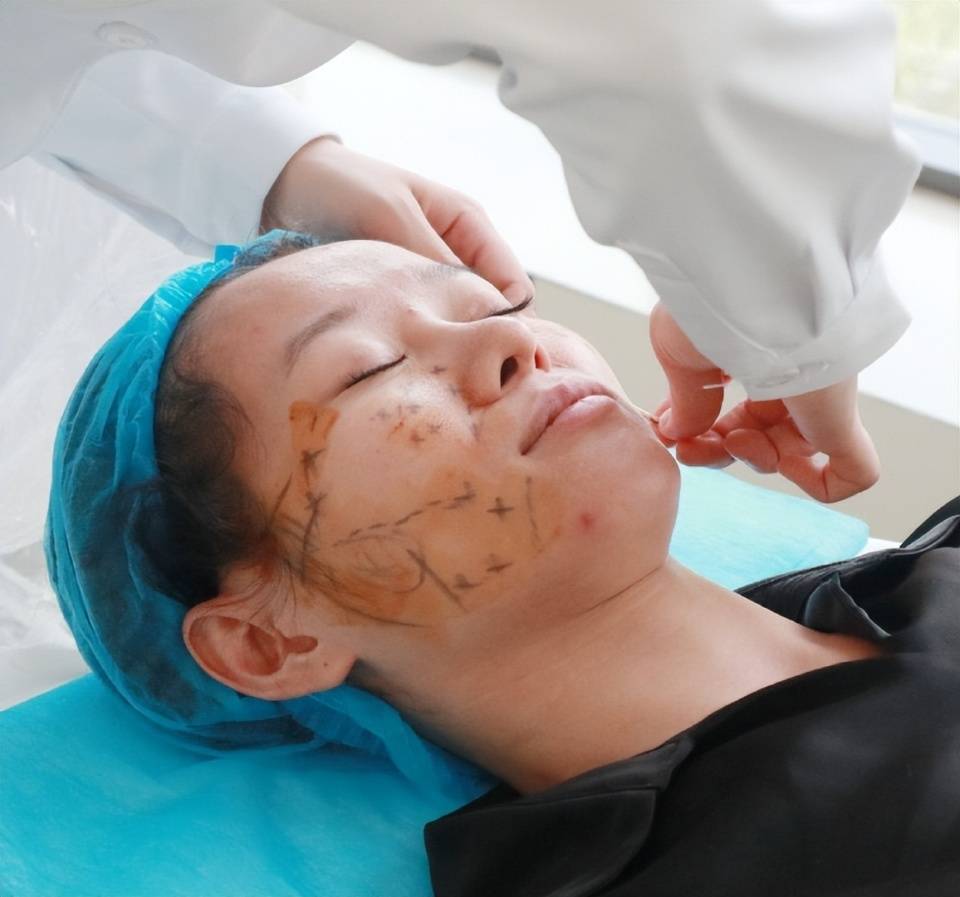 线雕和微拉美效果哪一个好,微拉美和线雕哪个更安全,对比来了