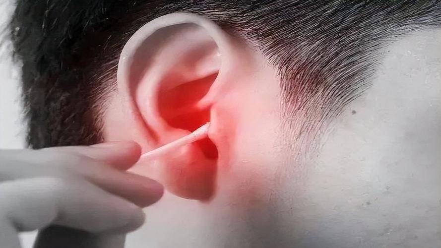 耳朵里面经常痒,却啥也掏不出来?或是4种病的表现,注意上点心