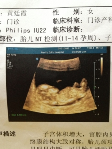 怀孕八周时,能够通过彩超观察到,胎儿的四肢和头部已经形成,已经是个