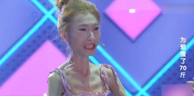 "骷髅妹"刘野自虐式减肥,从120斤减到57斤,直接吓跑网恋对象