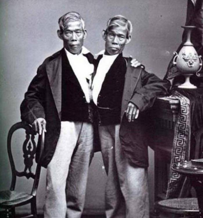 连体人如何结婚生子?连体兄弟娶美国姐妹花,共生育出22个孩子