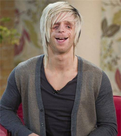 他先天脸部畸形,靠才华娶漂亮妻子,当孩子出生后,两人当场傻住