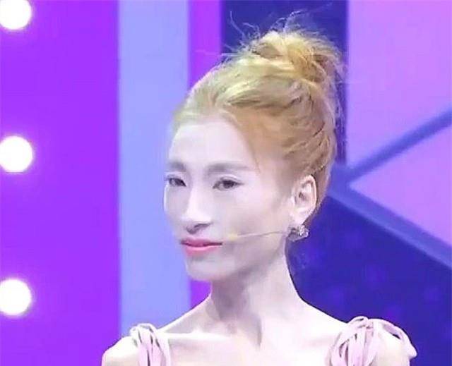 当年为了追求爱情,从120减到57的"骷髅妹",现在怎样了?