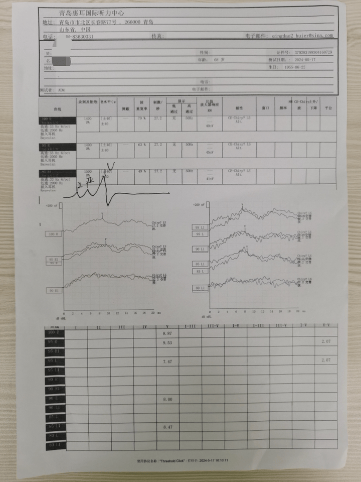 香蕉图下缘,右耳高频几乎没有提升,推断右侧2khz,4hz可能存在耳蜗死区
