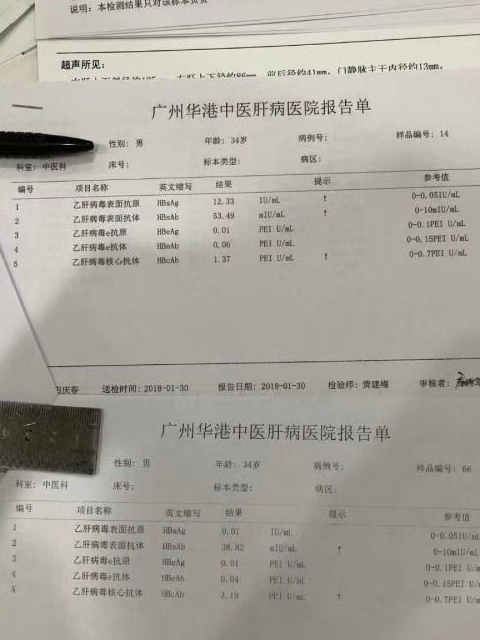 乙肝25阳性图片