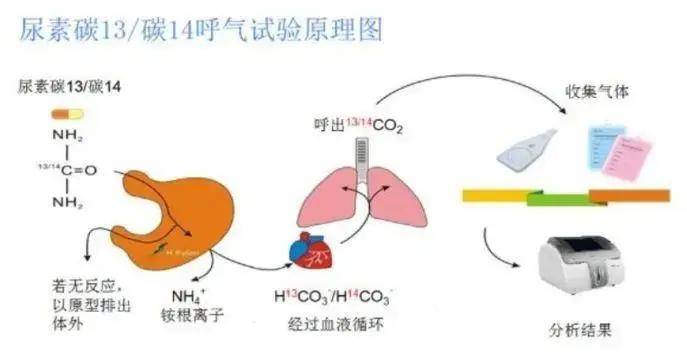 通过测定其呼出气体中同位素碳13或碳14标记的co2变化情况即可判断有