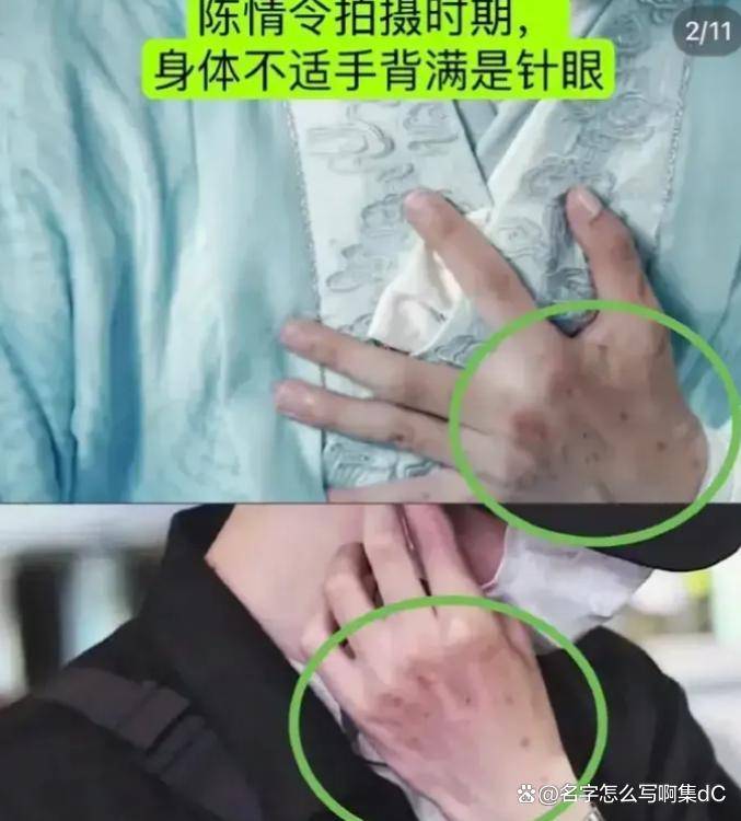 王一博最新露面依旧戴帽子,后脑疑似出现斑秃,国外看比赛散心