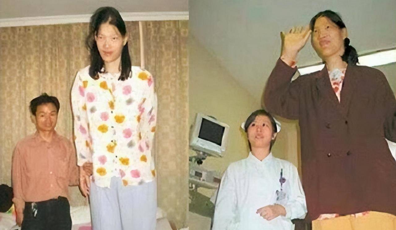 女巨人曾金莲:高2.48米,一顿吃2斤饭,鞋穿60码,遗体至今封存