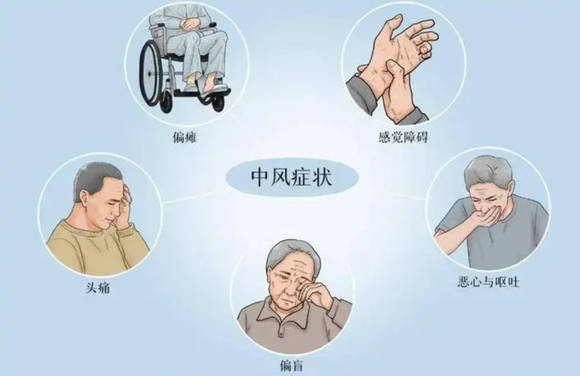 老年人如何预防脑卒中的发生?