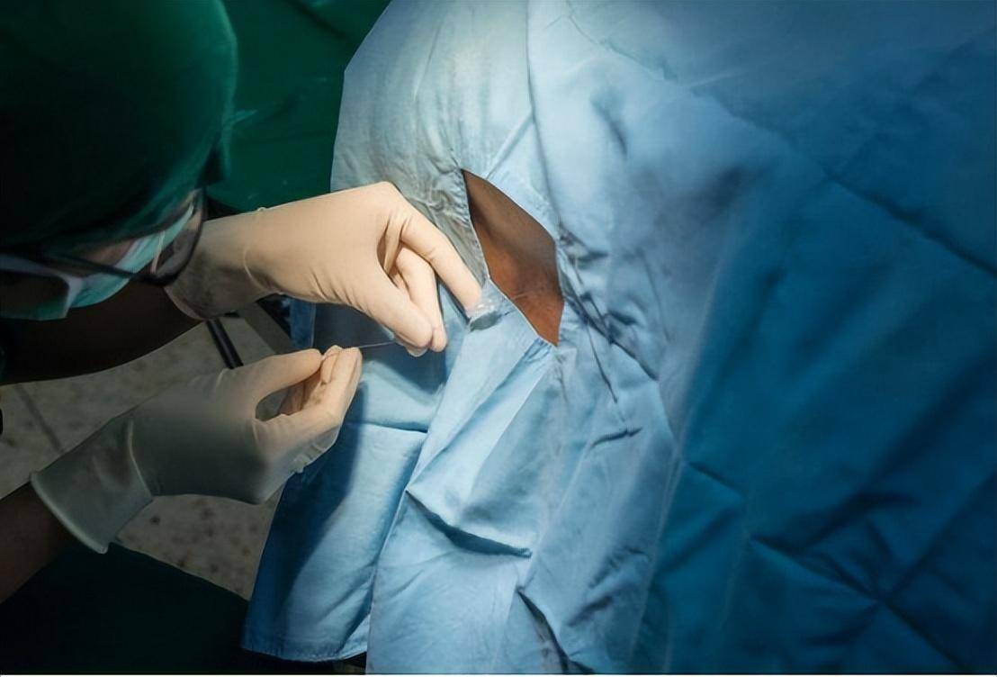 医生揭秘,麻醉时身体都在经历什么_手术_感觉_患者