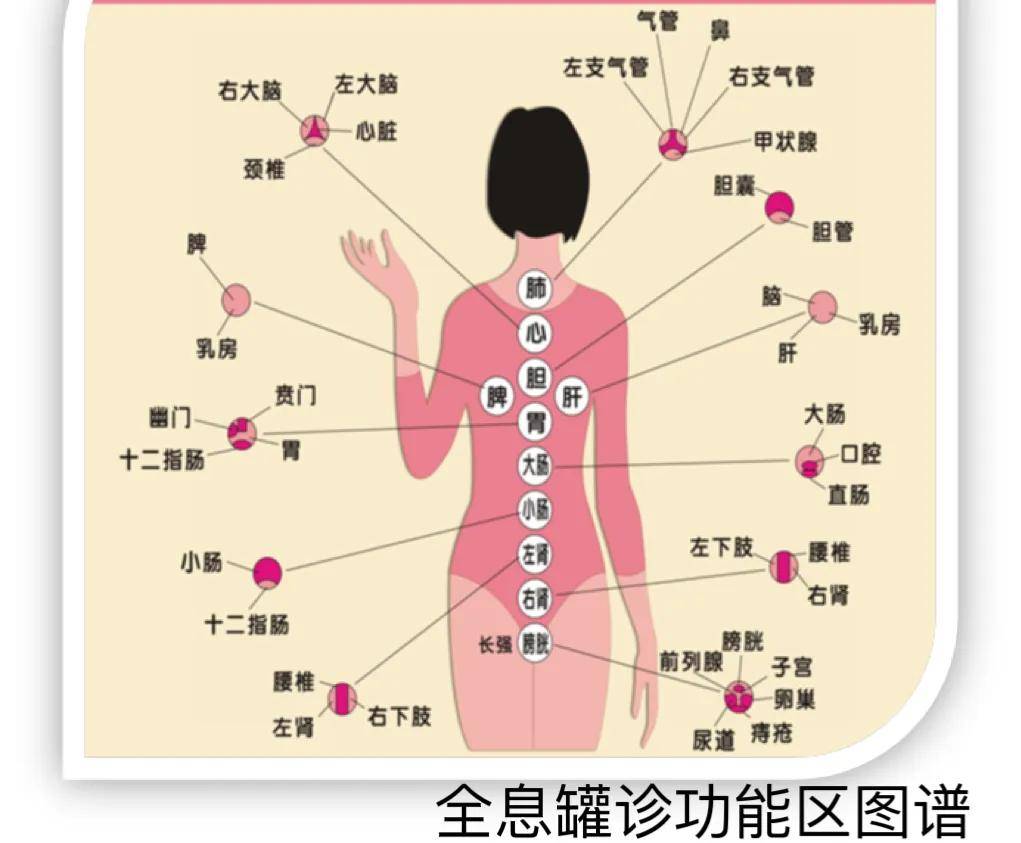 全息罐的出现,扩展了罐的角色,使之具备了诊断的功能