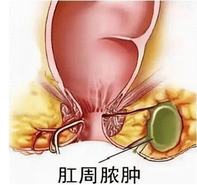 仓鼠脓肿早期症状图片图片