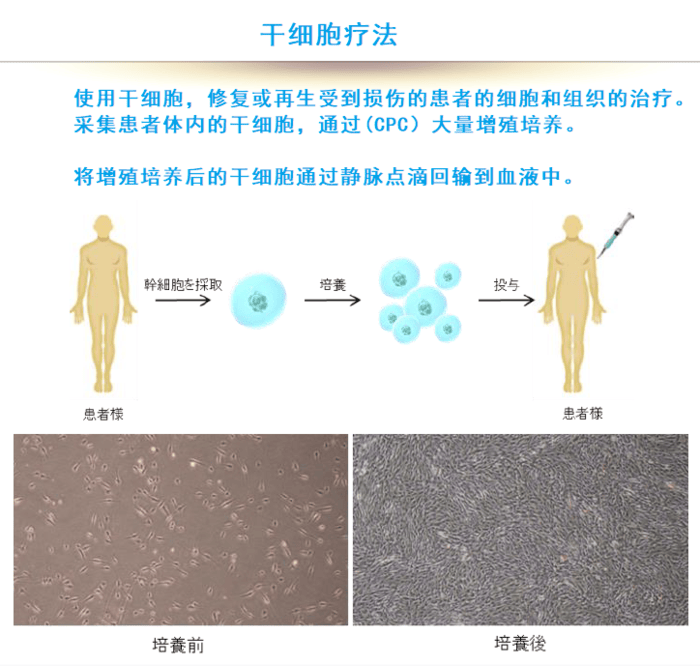 日本干细胞治疗鼻祖-(sf医院)-乐敦细胞培养室