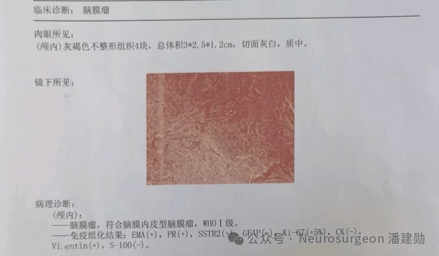 头部检查报告单图片图片