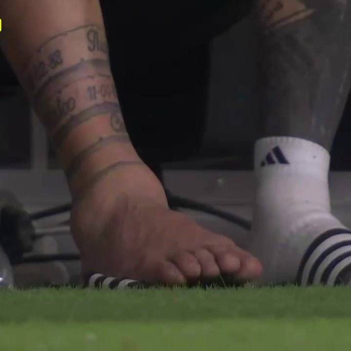 领袖!梅西脚肿得像馒头,仍一瘸一拐为队友加油,换来绝杀 3连冠