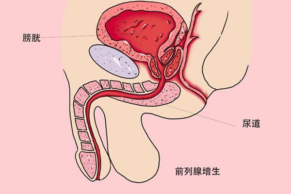 前列腺位置男身体图片