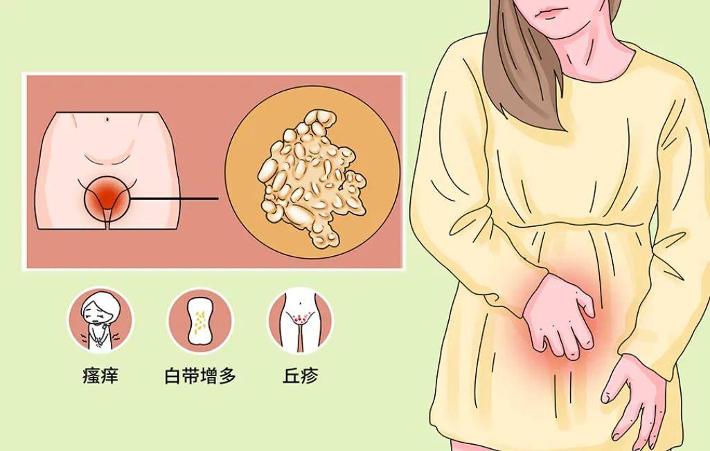 包括但不限于假性湿疣,生殖器鳞状细胞癌,皮脂腺异位,生殖器部位