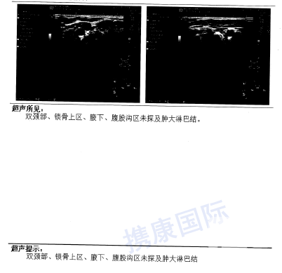 横纹肌肉瘤发病率图片