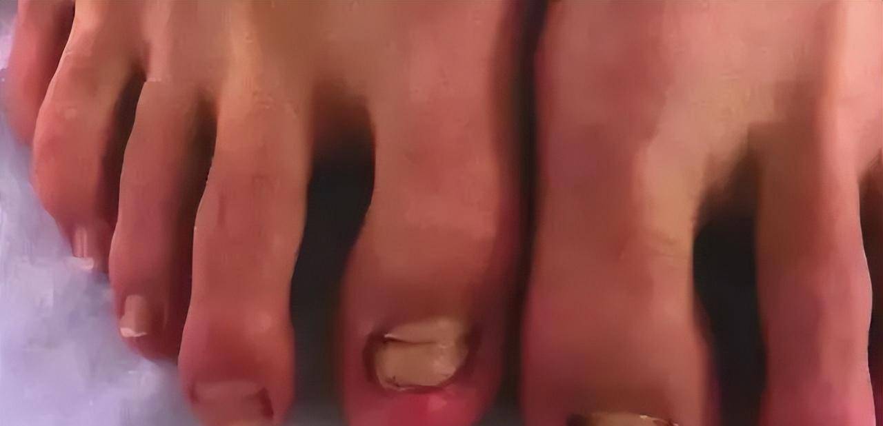 "温泉鱼"有多恐怖?吃脚皮只是在麻痹你,整条鱼进去只剩骨架