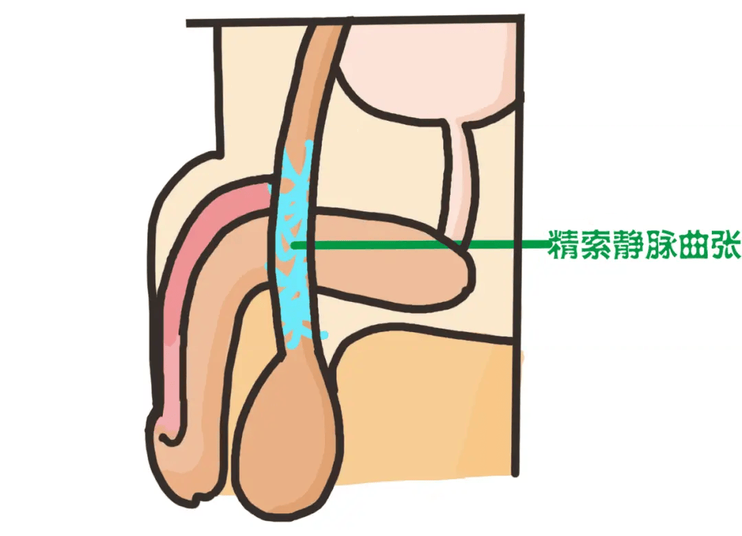 精索图片正常图片图片