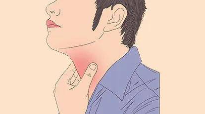 "益生军"来了丨慢性咽炎反反复复,别只怪嗓子!