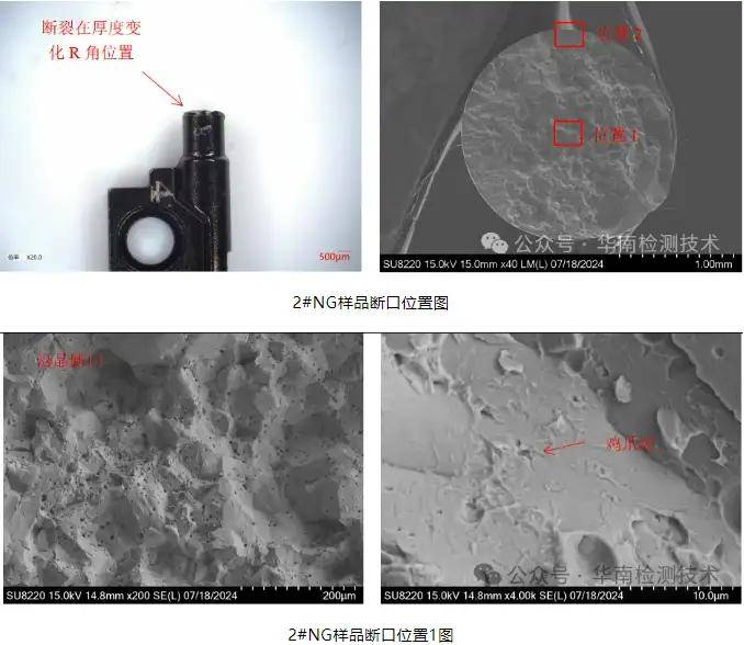 轴索断裂图片