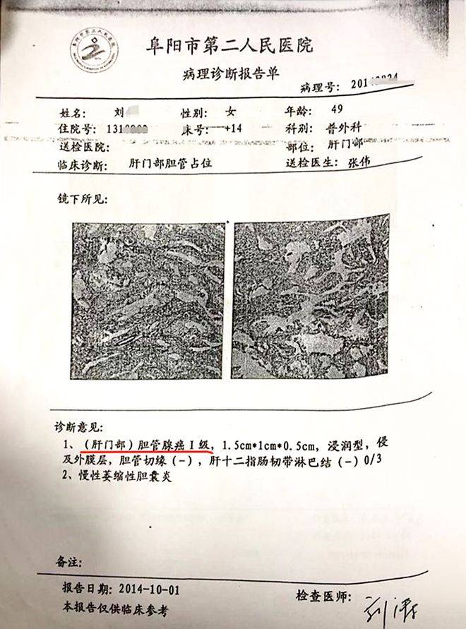 胆管癌10年,从绝望到重生的奇迹