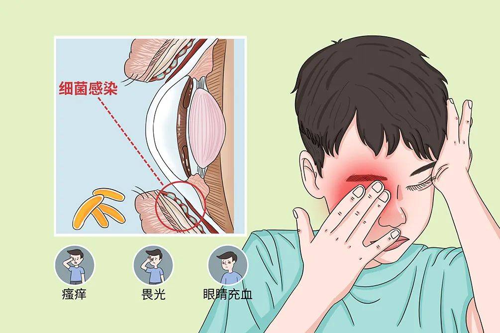 眼睛疼动画图片