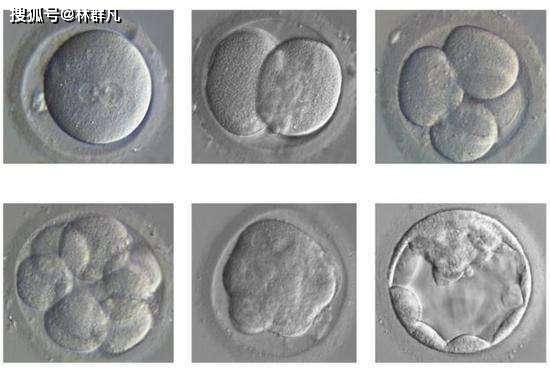 林群凡分享 试管婴儿囊胚移植有何优点和缺点?