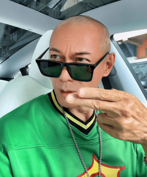 郑少秋脱发几十年,永远都是顶着假发示人,保持自己风流倜傥的模样.