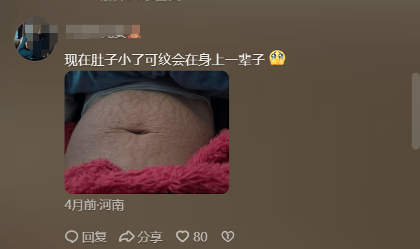 26岁女子晒出自己产后布满妊娠纹的肚子,产后身材走形的原因？