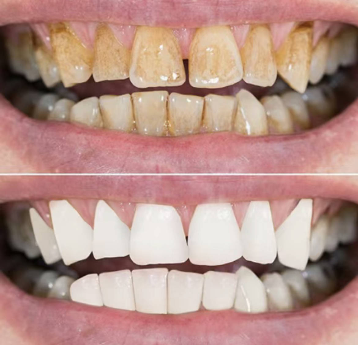 三步刷牙法根除牙黄黑渍!学会白牙一步到位!_牙齿_牙粉_效果