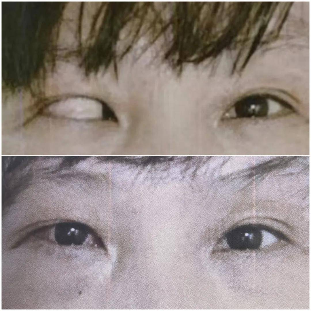 到漳亲诊的斜视与小儿眼科专家修阳晖出席中华医学会第二十八次眼科