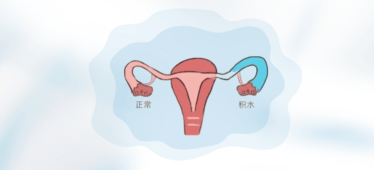 输卵管不通畅/粘连/堵塞/积水,还能怀孕吗？