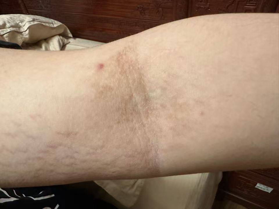 为啥我变胖了,这里还变黑了?医生:还能治!