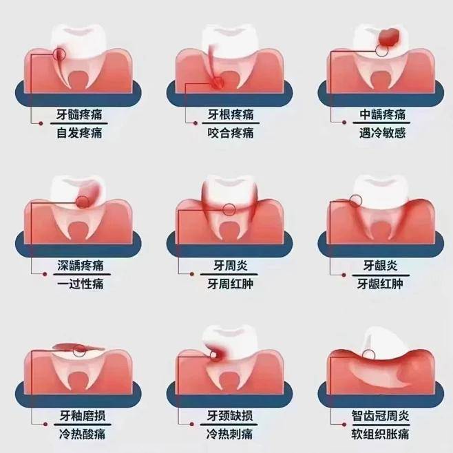 上牙智齿位置图图片