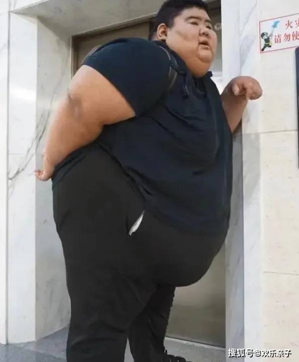 减肥之路:从手术到自我努力02他