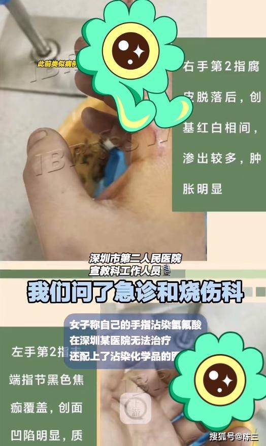 院方表示:未收过该病例_氢氟酸_化学品_网友