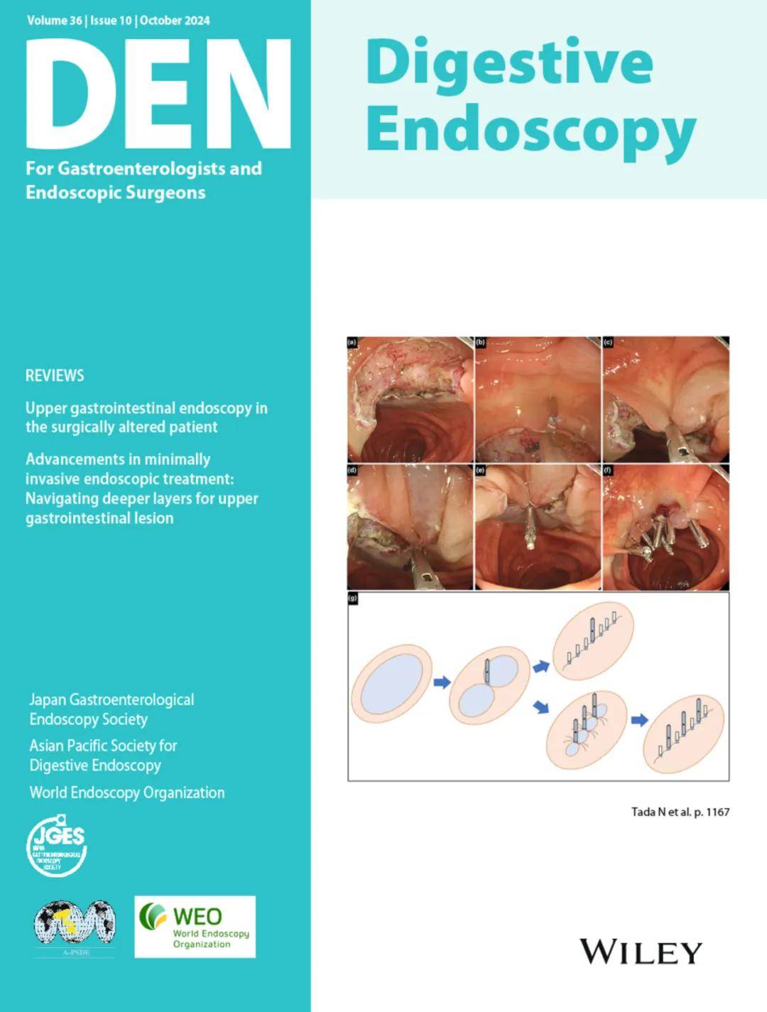 图片来源:期刊官网期刊简介digestive endoscopy《消化内镜》(den)是