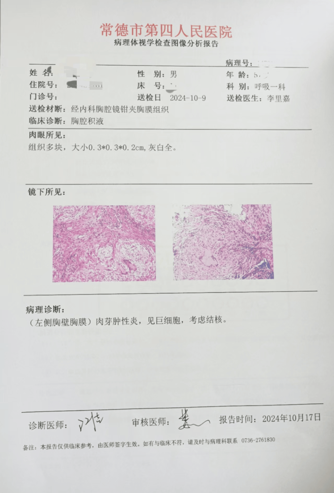 术后,安伯伯的胸膜病检结果显示为肉芽肿性,见巨细胞,考虑诊断为结核