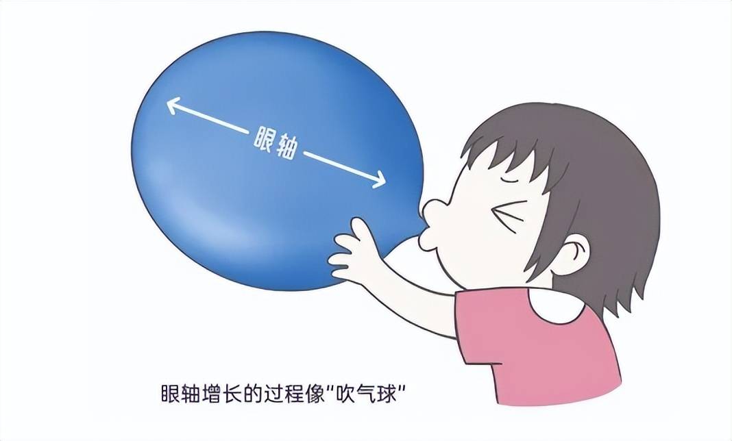 就像吹气球一样,气球吹得太大,气球壁就会薄,就可能有爆炸的风险