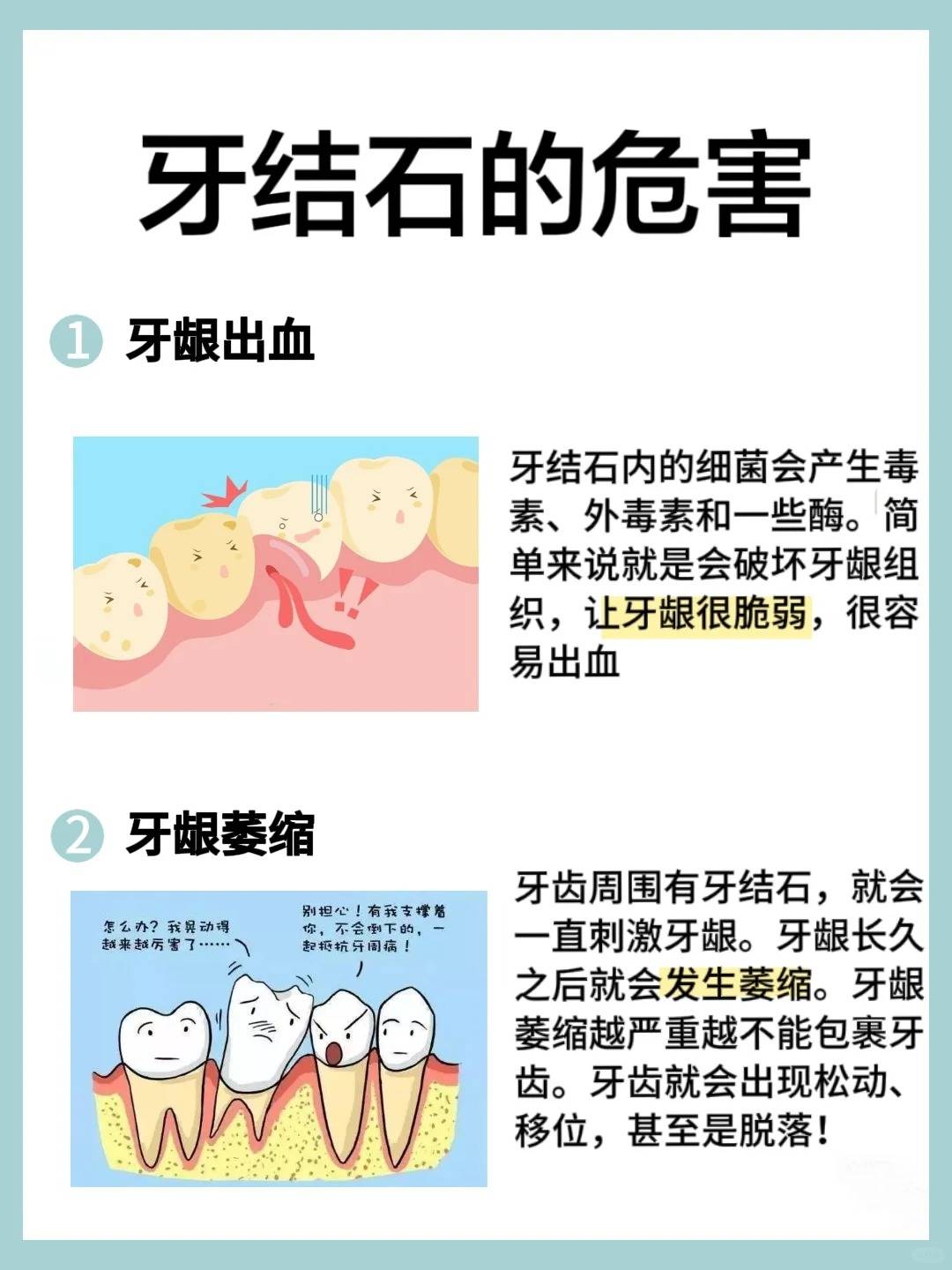 牙结石的危害图片